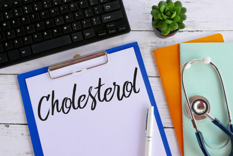 Cholesterol and perimenopause: when is time to pay attention